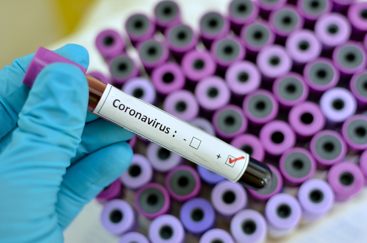 Coronavírus e o paciente idoso